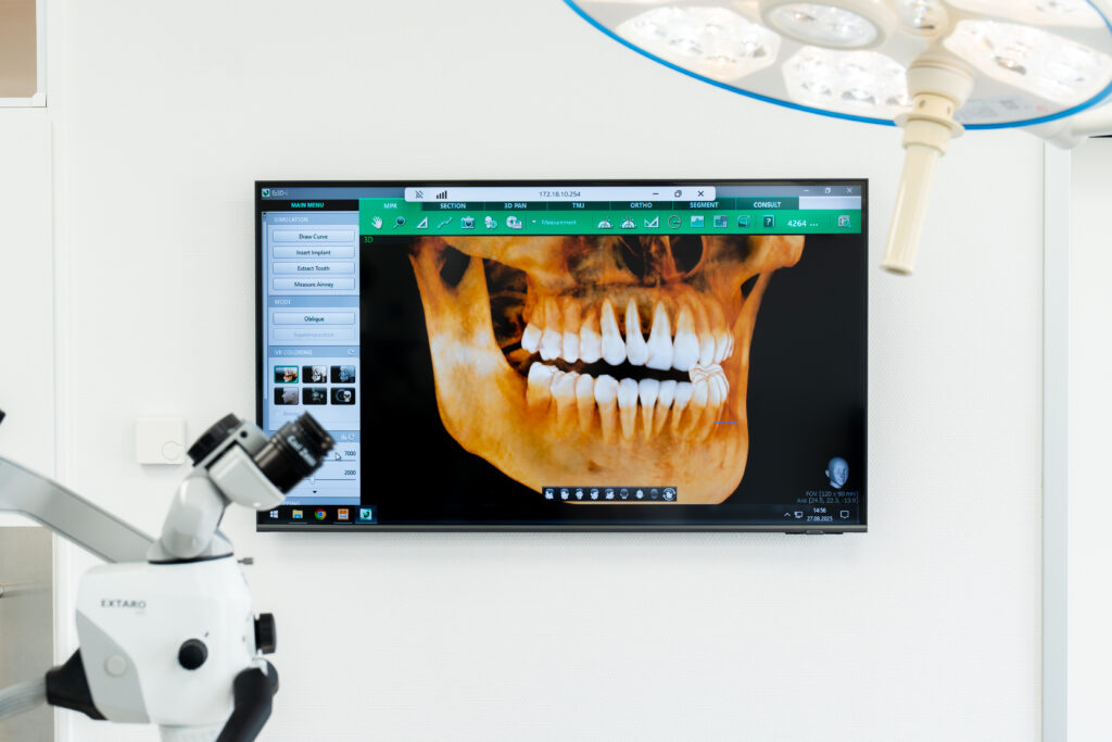 3D-Darstellung eines Kiefers auf einem Bildschirm mit Zahnimplantaten – digitale Diagnostik und moderne Bildgebung in der Zahnklinik Nordhorn.